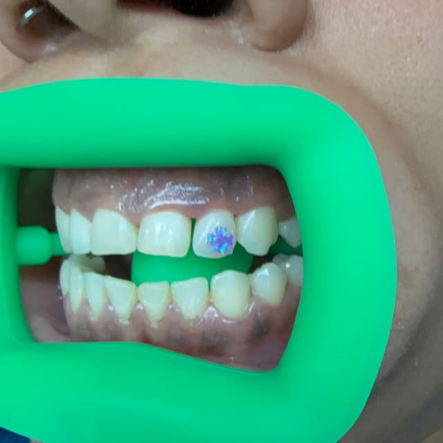 JemCare Membership — $9.99/month at Jem Junkies